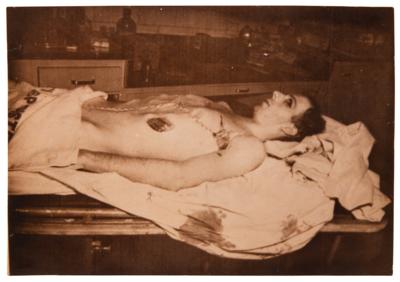 Lot #148 Lee Harvey Oswald Autopsy Photograph - Image 1